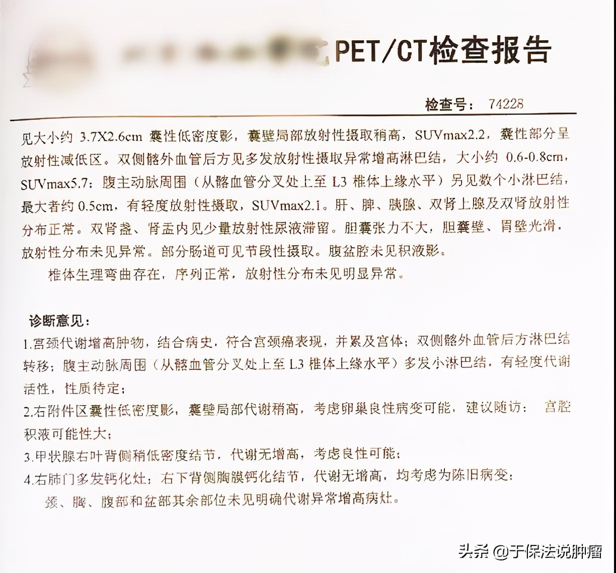 32岁宫颈癌患者，有强烈生育愿望，经治疗病灶缩小明显