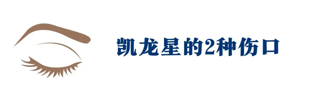 凯龙星疗伤3部曲:看懂这4种隐秘人格,给你疗愈一切的力量 |深度