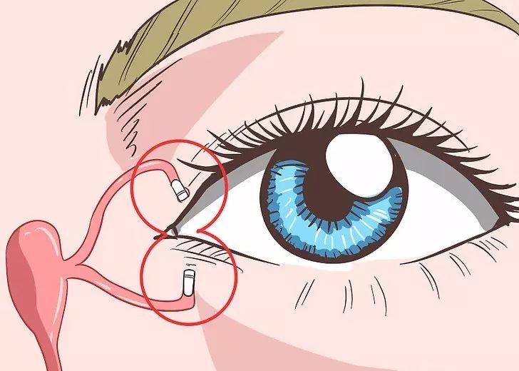 为什么眼睛总流眼泪？可能和这5种疾病有关，别大意！