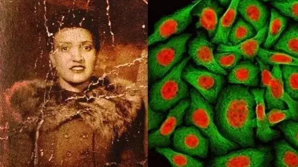 永生不死的癌細胞 至今已繁殖代 遍佈世界各地 趣探索一號 Mdeditor