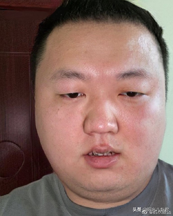 Net merbromin elder brother grow stout is serious! Take a picture oneself steamed bread of just like leaven dough, netizen proposal is incognito call affusion elder brother