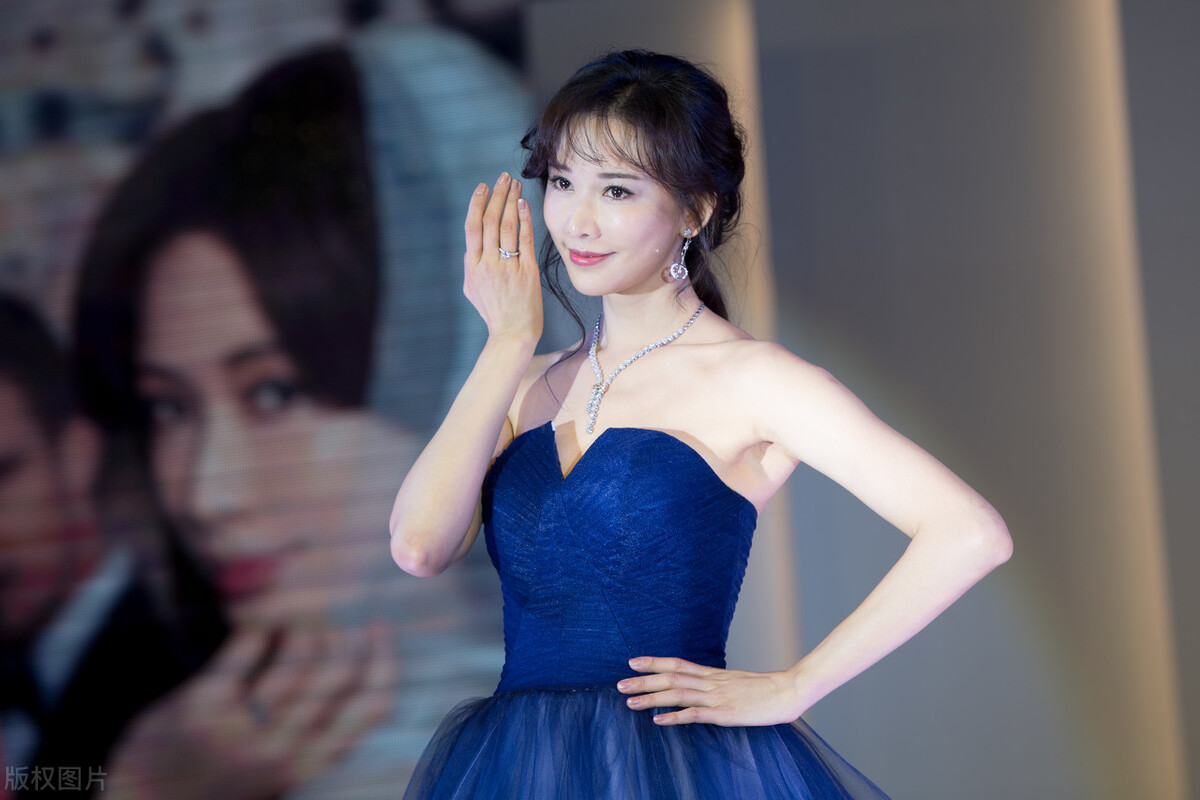 林志玲与妈妈合影，网友被腿上淤青吸引，引发猜测：被老公家暴？