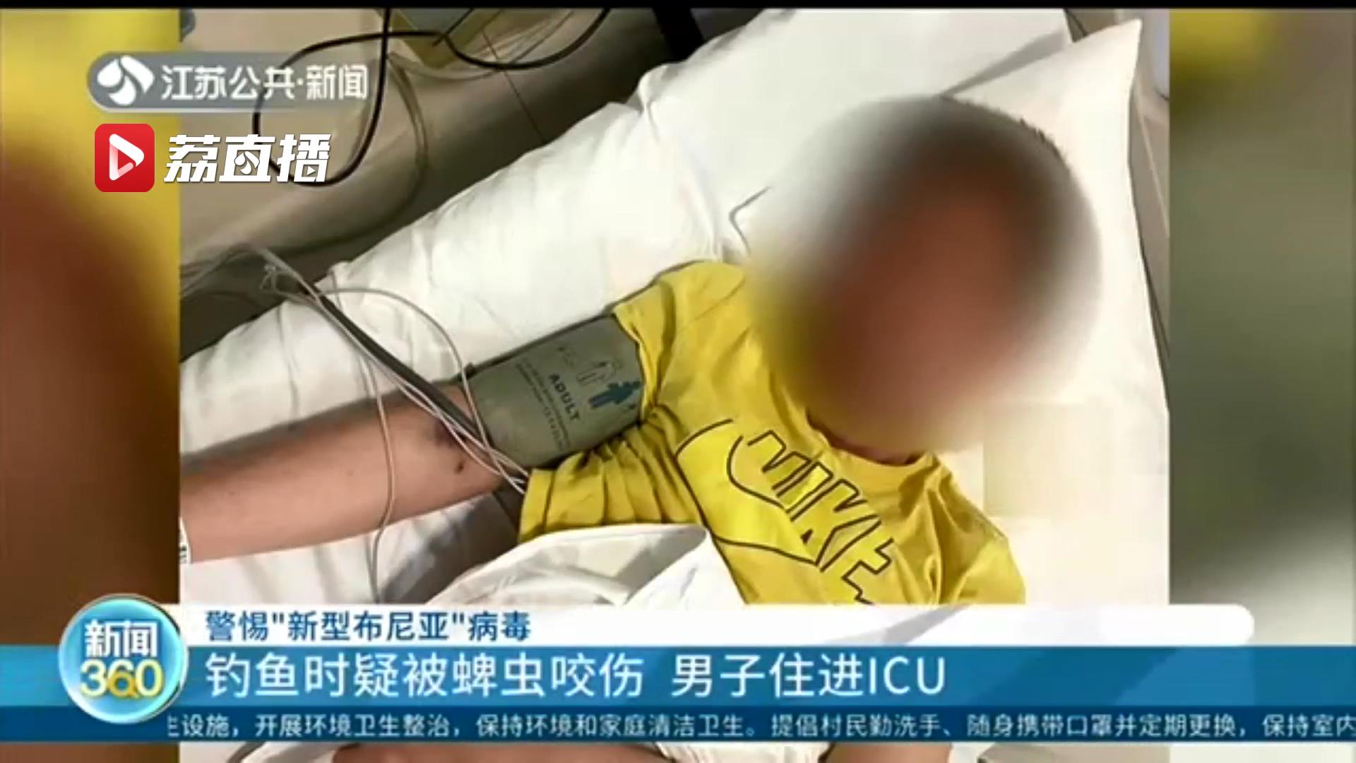 警惕“新型布尼亚”病毒！钓鱼时疑被蜱虫咬伤 男子住进ICU