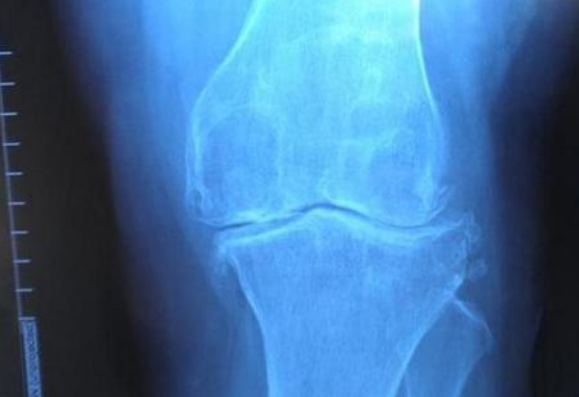 人体早被淘汰掉的器官，如今开始重新出现，是