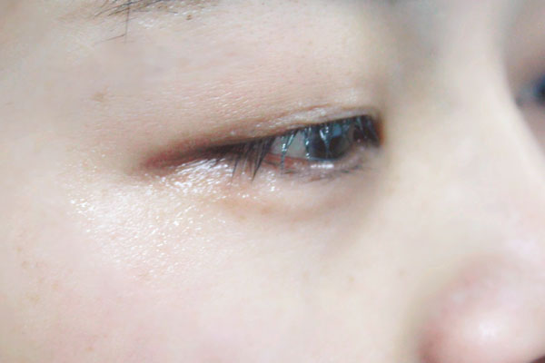 眼睛经常不自觉流眼泪是怎么回事？该如何改善？不妨了解下