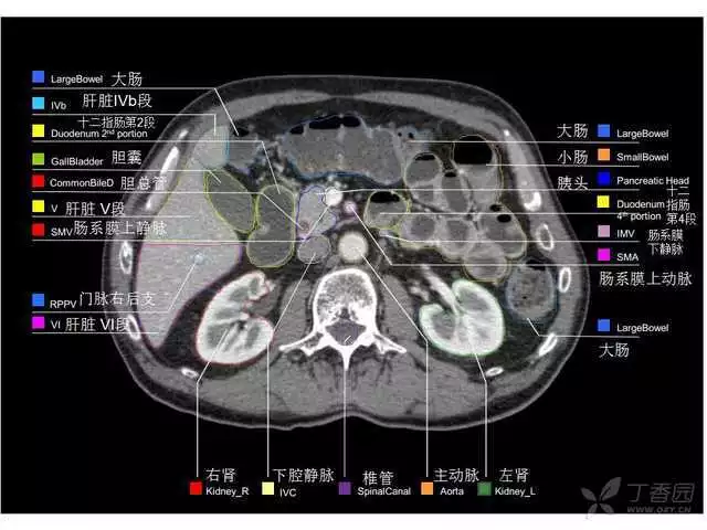 掌握这篇解剖，晋级腹部CT影像诊断高手（精细版）