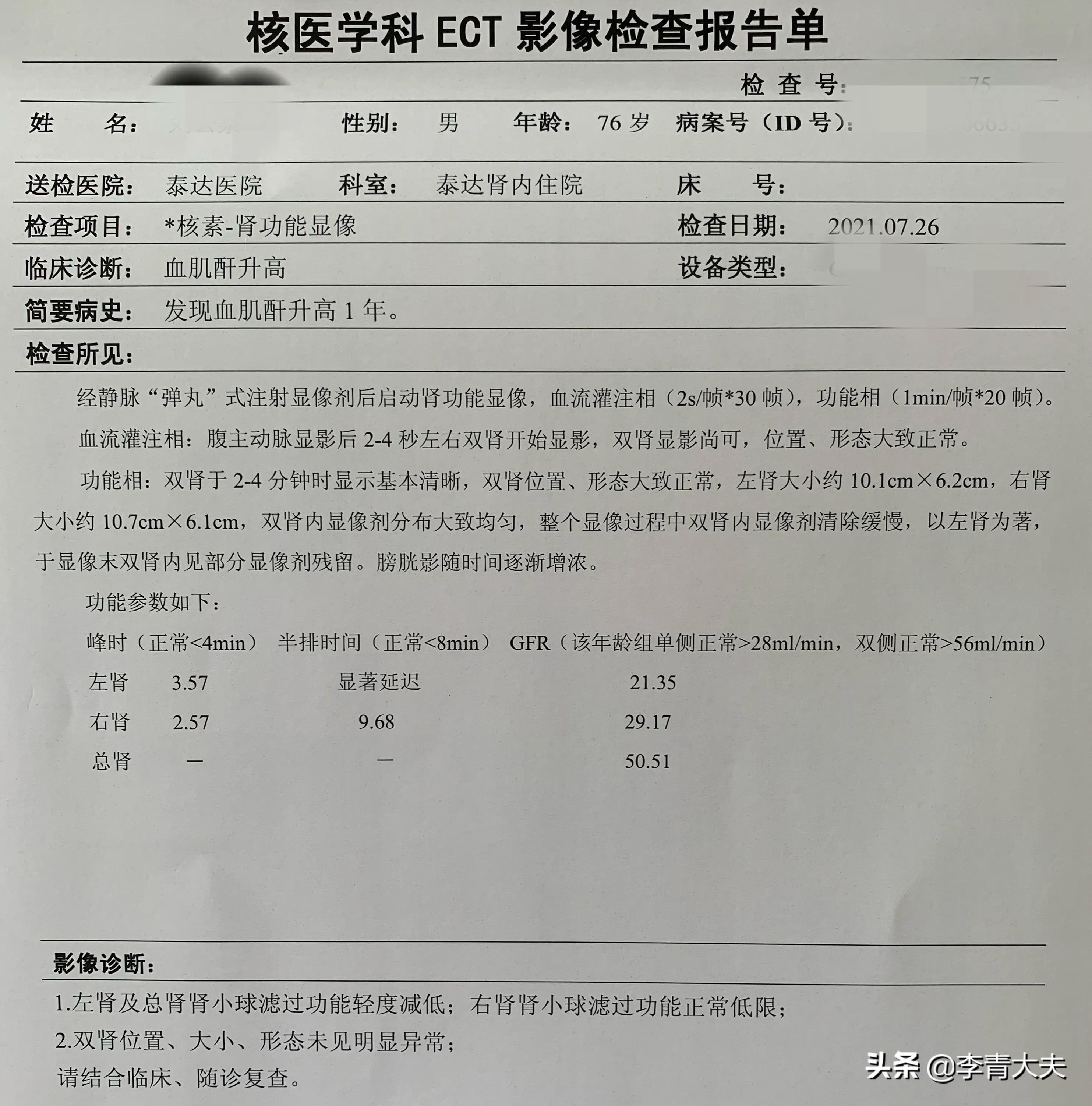 一例痛风性肾衰暴露了痛风治疗的三大误区
