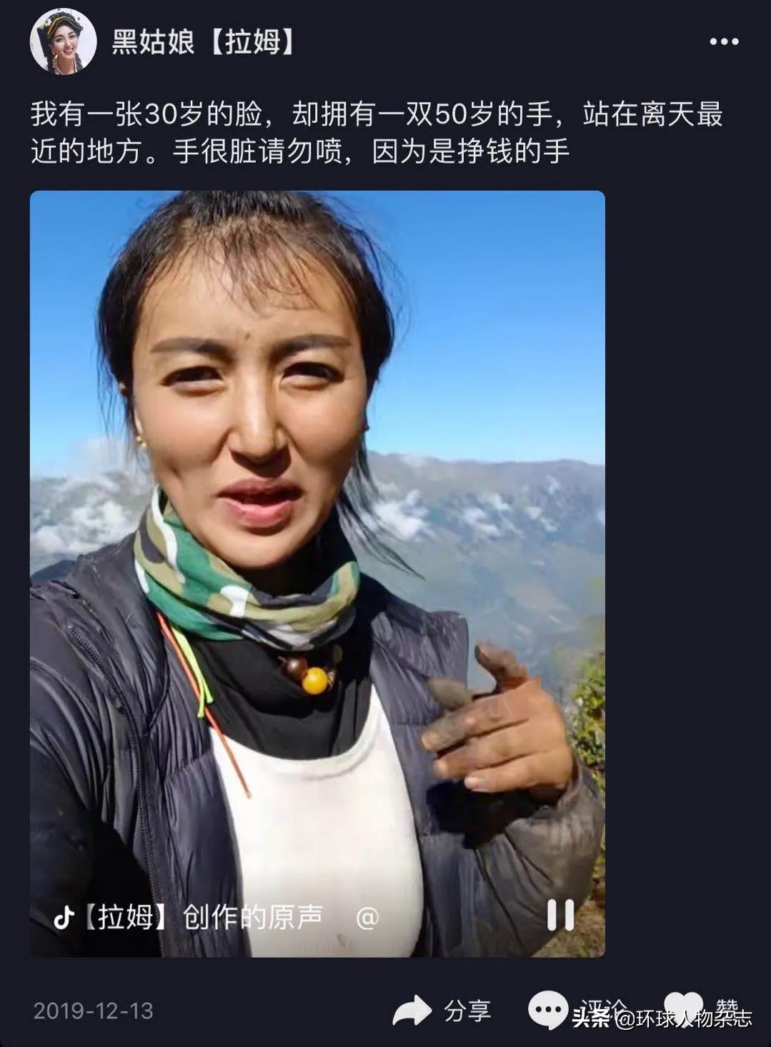 美女网红被前夫泼汽油烧到焦黑，竟然还有人为犯罪者开脱