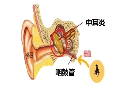 明明是耳朵不舒服，为何要使用滴鼻剂？