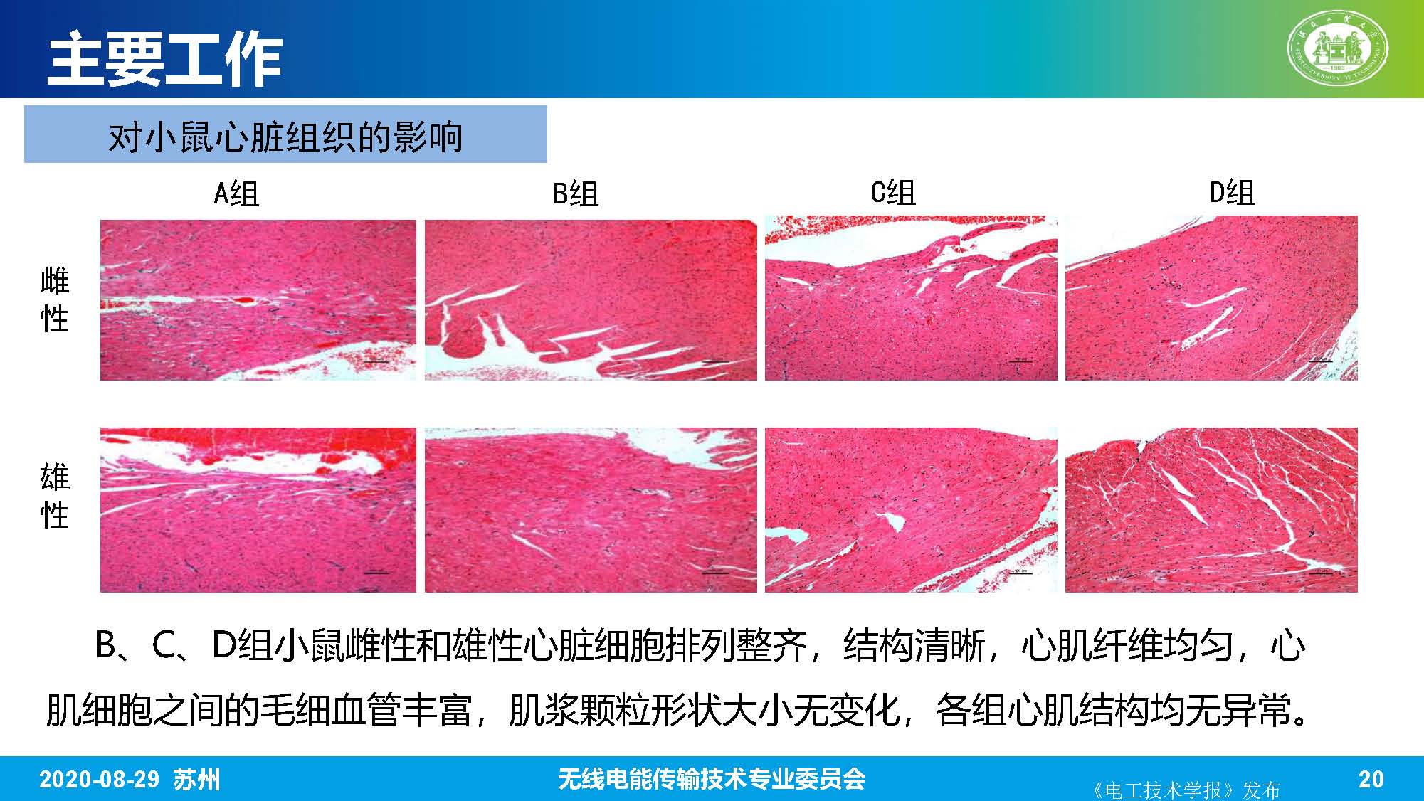 河北工业大学赵军博士：无线电能传输系统的生物电磁综合效应研究