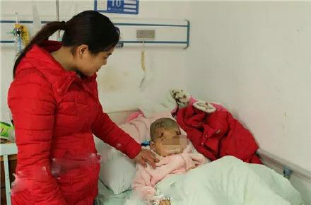 护妹小英雄！美国6岁男孩斗恶犬缝90多针，中国5岁男童被藏獒咬伤