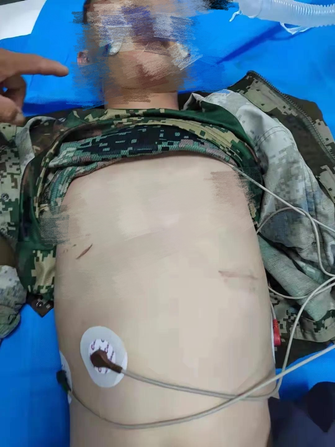 山东交通技术学院学生疑被打死，学校处理态度冷漠