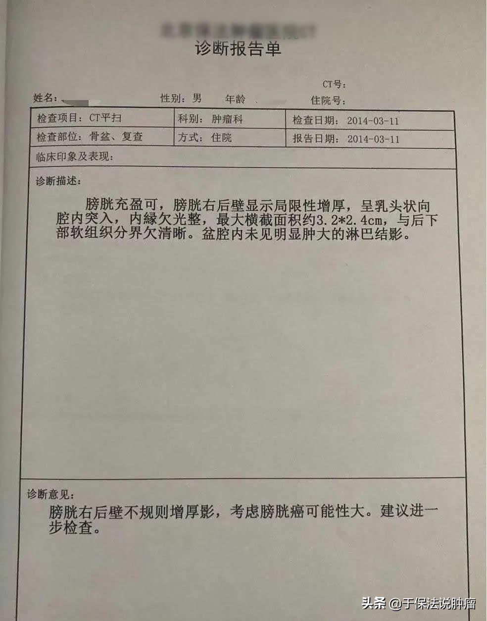 膀胱癌患者经历8次手术后，选择缓释库疗法，治疗后至今8年未复发