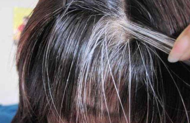 白头发越长越多，是怎么回事？医生：或是体内缺了2种维生素