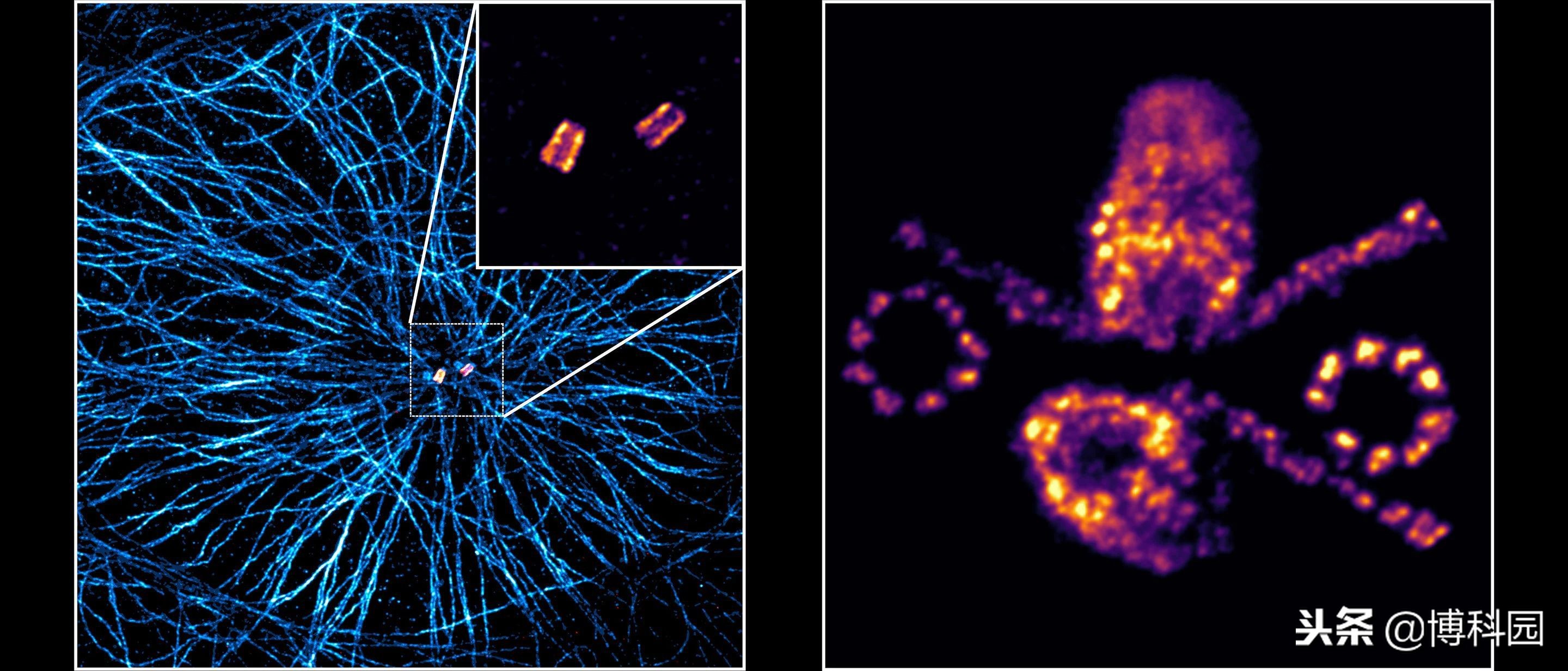 你还不知道吧？超分辨显微镜最新研究进展！