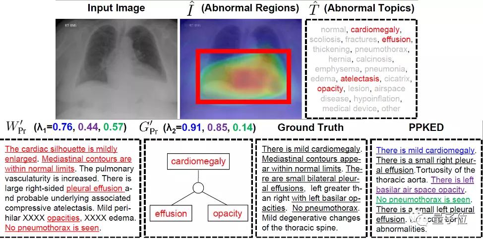 AI能写出靠谱医学报告了，CVPR2021收录｜腾讯医典出品