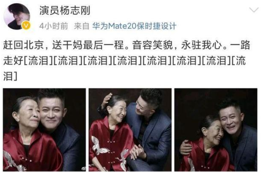 “丑娘”张少华去世，她患的这种病，至今仍困