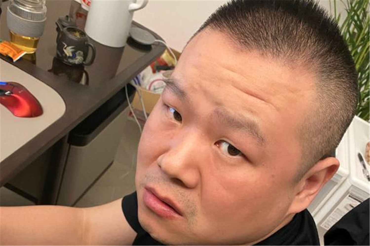 郑敏高情商化解岳云鹏危机，现剃光头住院，岳