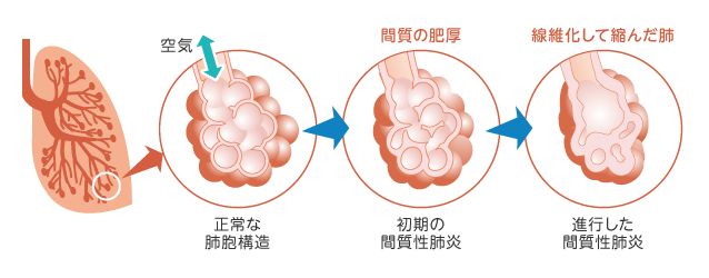 优势互补！理邦仪器与积水医疗战略合作
