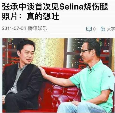 Selina坎坷的经历：29岁全身54%被烧伤，35岁离婚，38岁嗓子失声