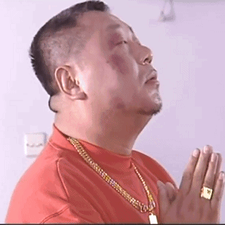 妹纸嫌额头巨大，去做缩额术，将发际线拉低3厘