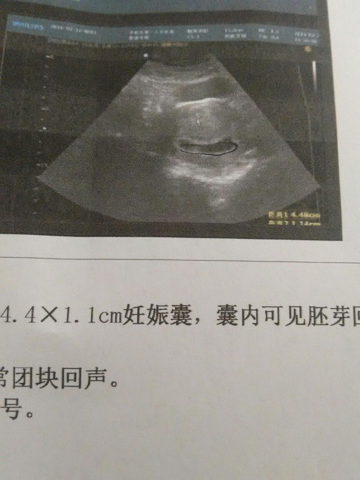 二胎性别有暗示：一胎宝宝长得像爸爸，二胎生男孩？