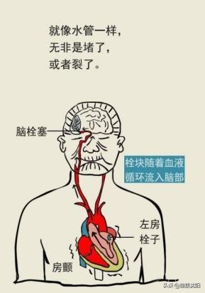 健康知识普及行动系列科普知识讲座之重大疾病篇