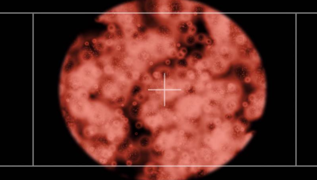 比新冠還致命？ 非洲現未知疾病：症狀似埃博拉，死亡率高達90%