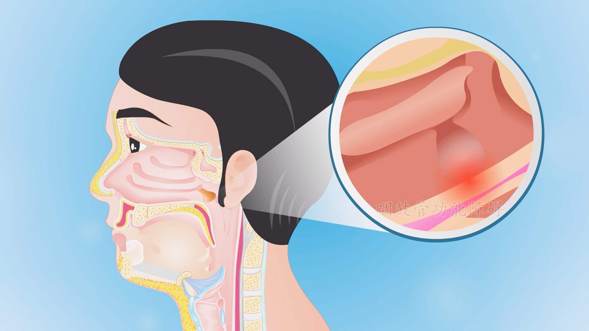 這3種水果是純天然的�消炎果�，經常吃，養肺化痰，咽炎消退