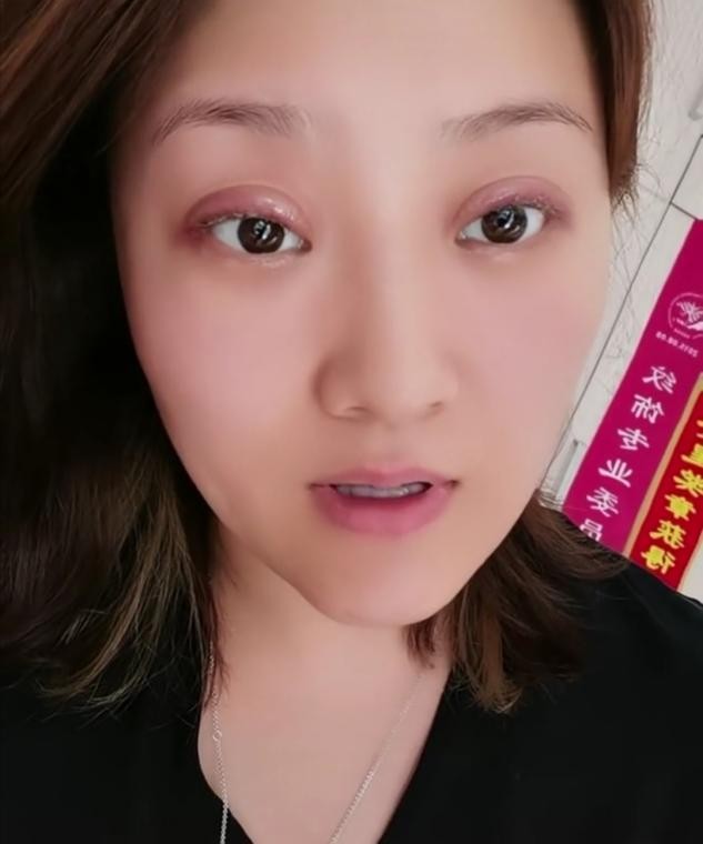 乡爱王云称整容失败，晒近况眼皮红肿超显眼，哭笑不得疑疼痛难忍