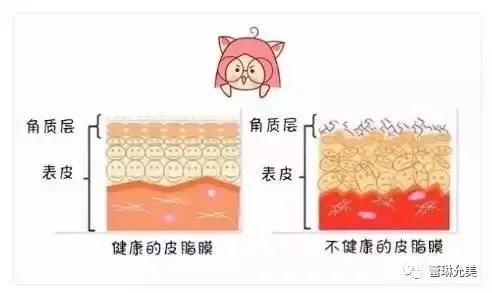 面对冬季各种皮肤问题，唯诺雅认为补水才是硬道理