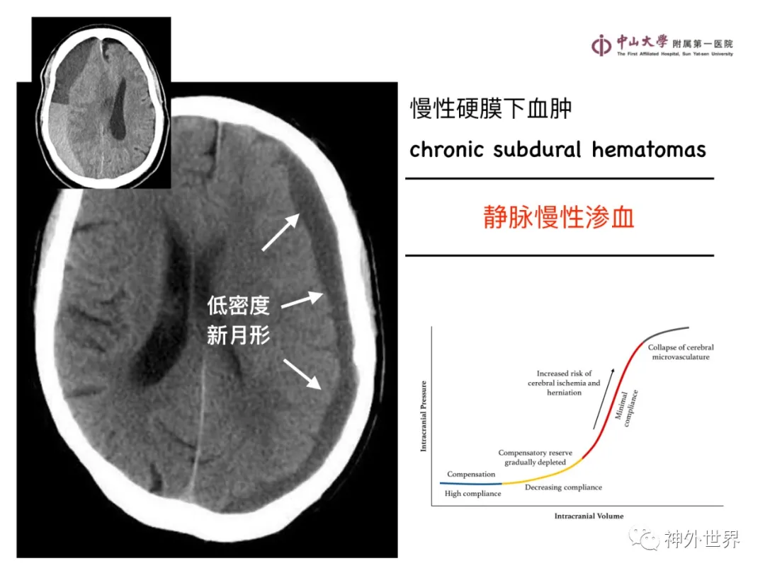 最全影像总结 | 颅内病变 MR、CT 的阅片技巧，太赞了