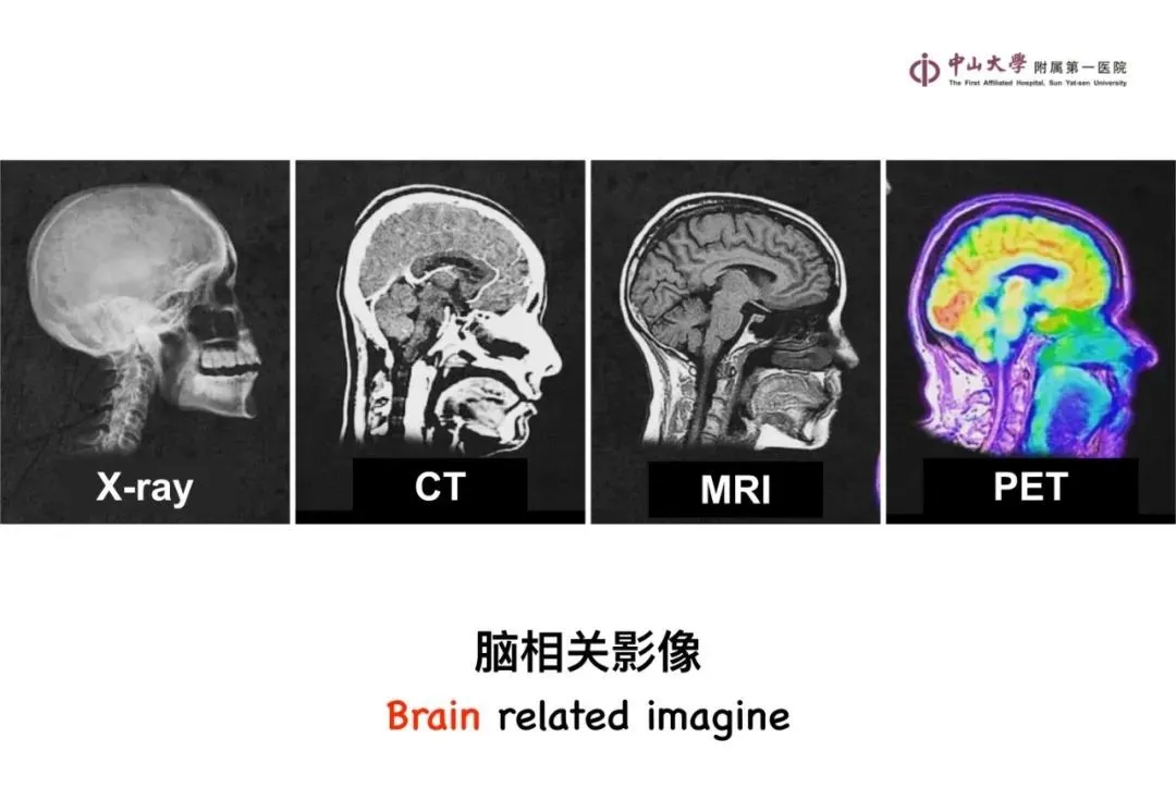 最全影像总结 | 颅内病变 MR、CT 的阅片技巧，太赞了
