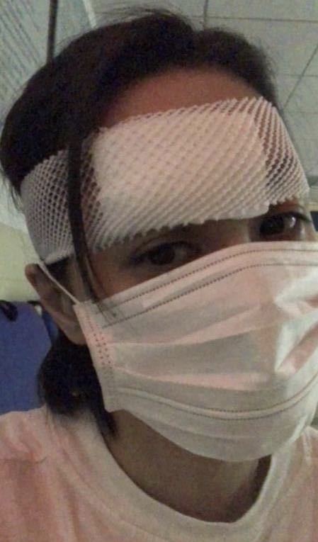 阿娇受伤过程及住院照曝光，老板杨受成正式回应：需要做二次手术