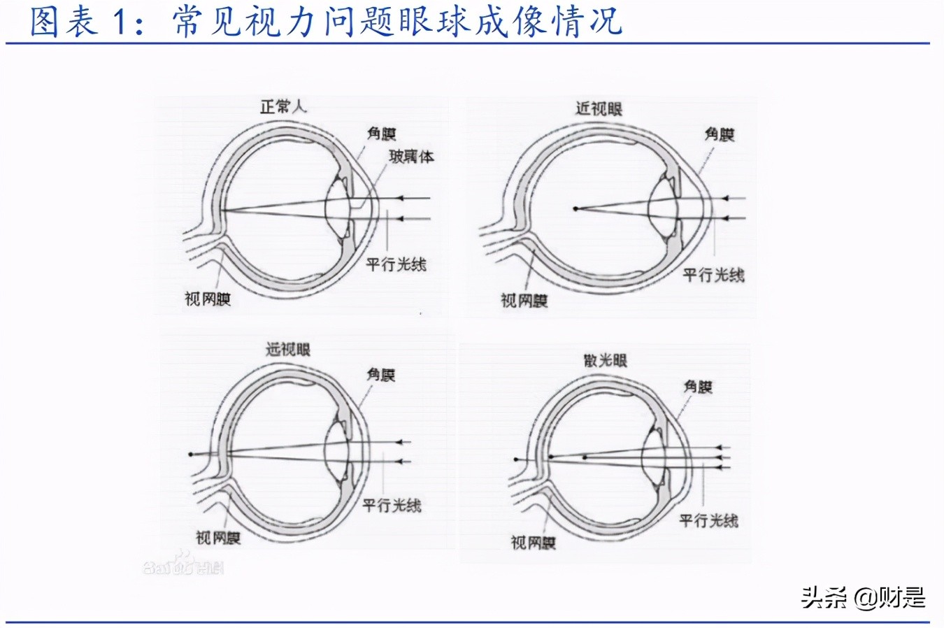 角膜塑形镜行业之欧普康视专题研究报告