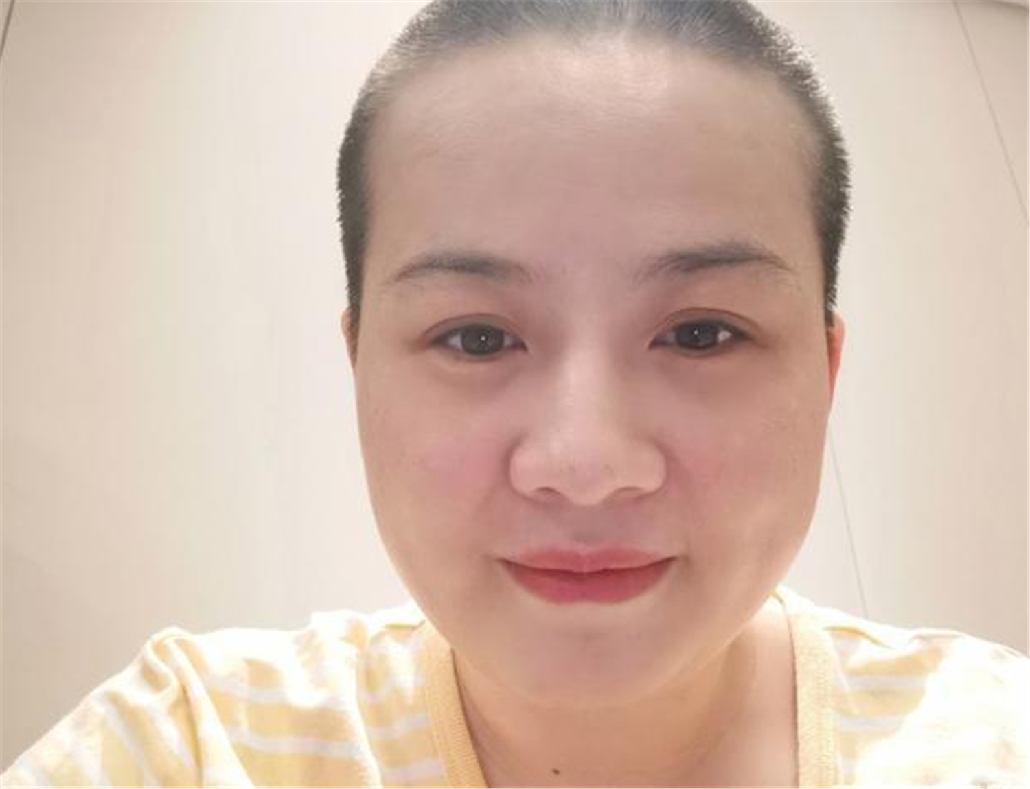 郑敏高情商化解岳云鹏危机，现剃光头住院，岳