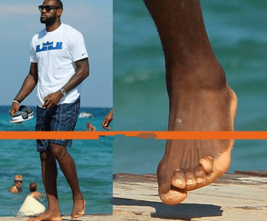 NBA球员赚上千万很容易？看这些照片就明白，詹姆斯脚趾变形