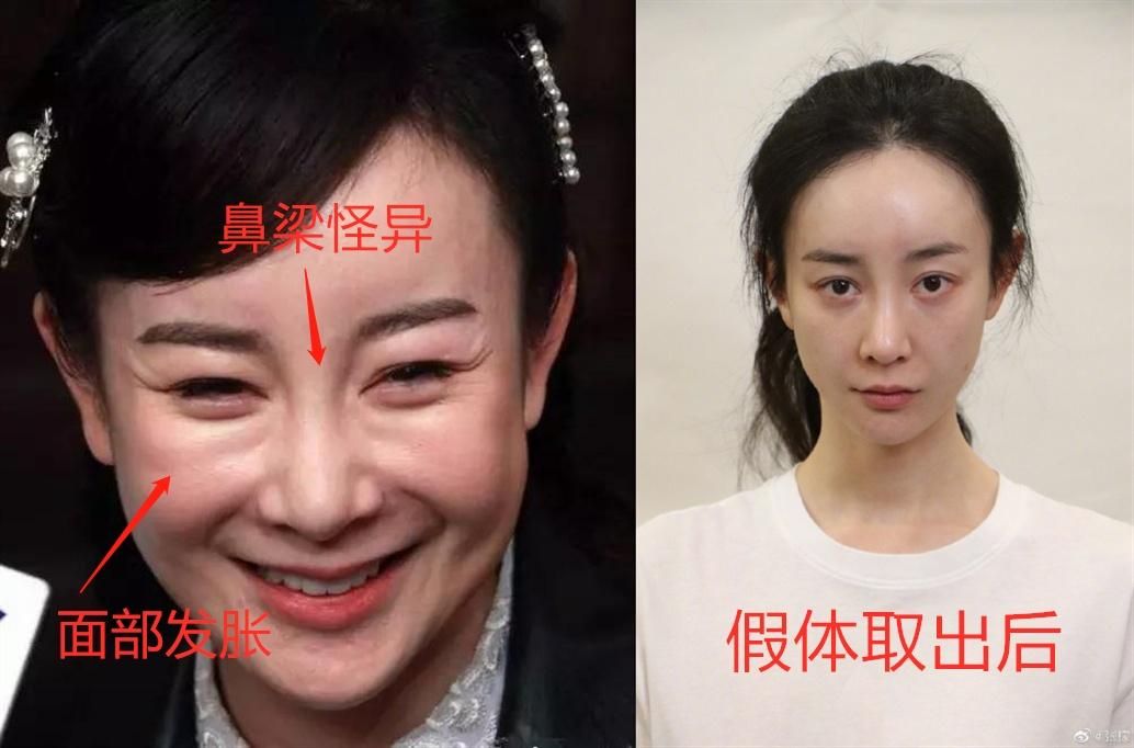 10位“整容上瘾”的女星，明知硅胶脸恐怖，为何还是前仆后继？