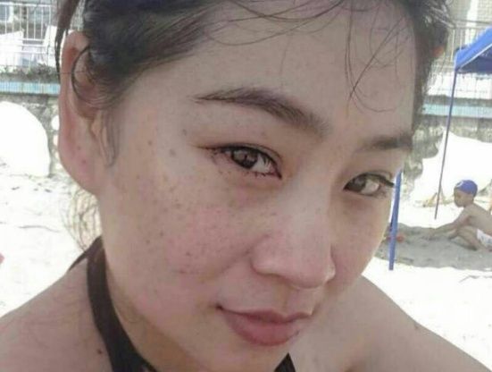 开塞露也可以补水祛斑？阿姨每天用它抹抹脸，皮肤水嫩白里透红