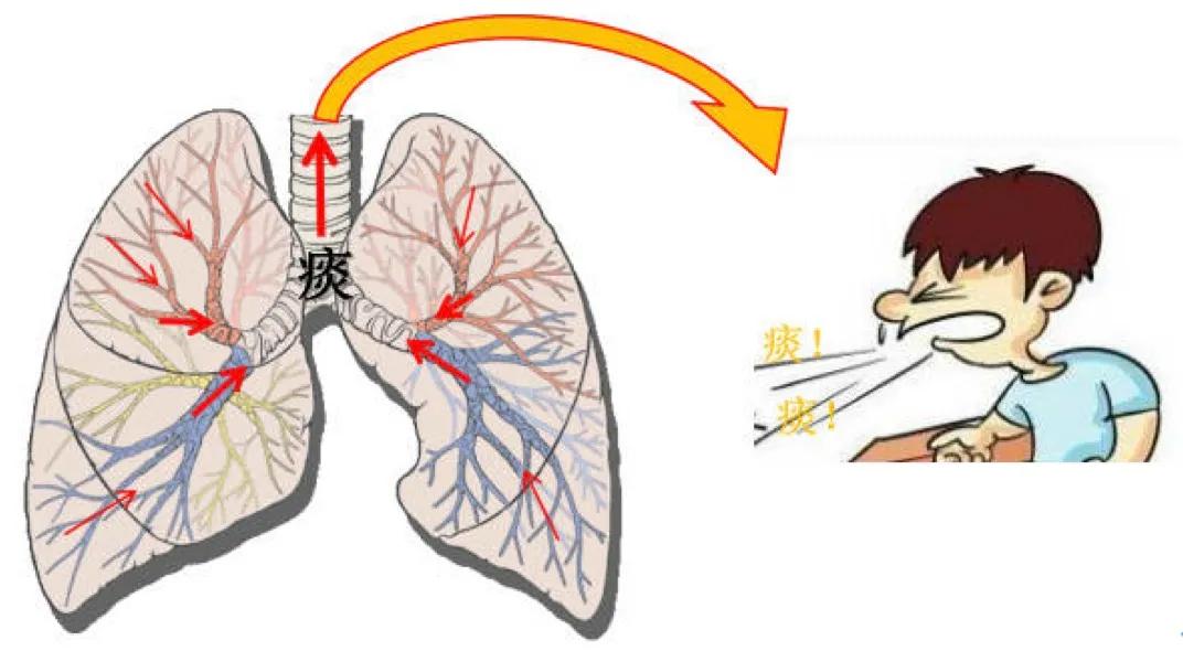 近1亿中国人患有这个病！治疗慢阻肺，用好祛痰药很重要