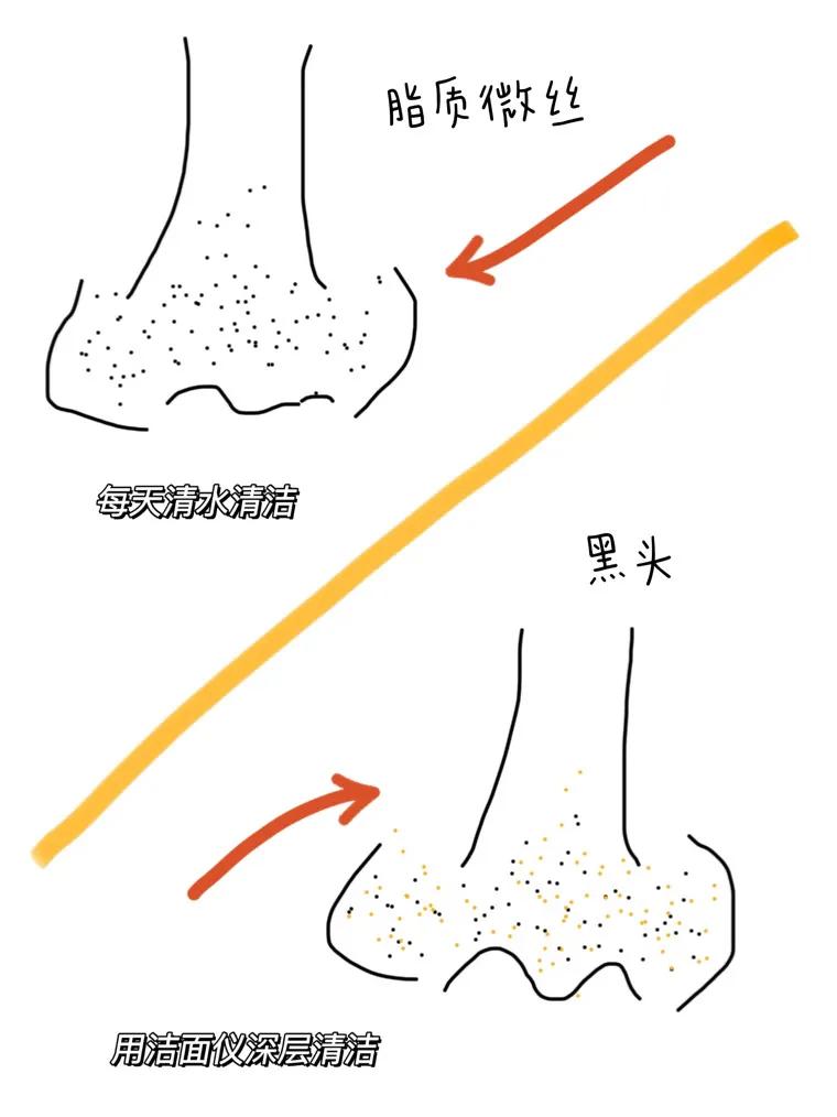 姐妹們原來這樣去黑頭才是正確的