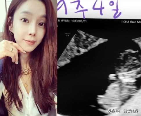 女星黄智贤宣布怀孕 是玄彬首度承认的女友 退圈6年嫁企业家