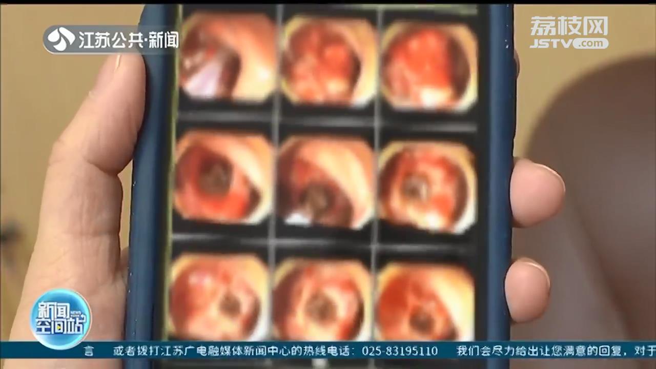 小伙连吃半盆油闷春笋 消化道出血险丧命