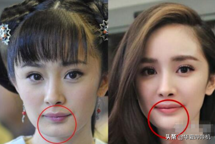 明星大型“翻车”现场，她们是如何整容变毁容