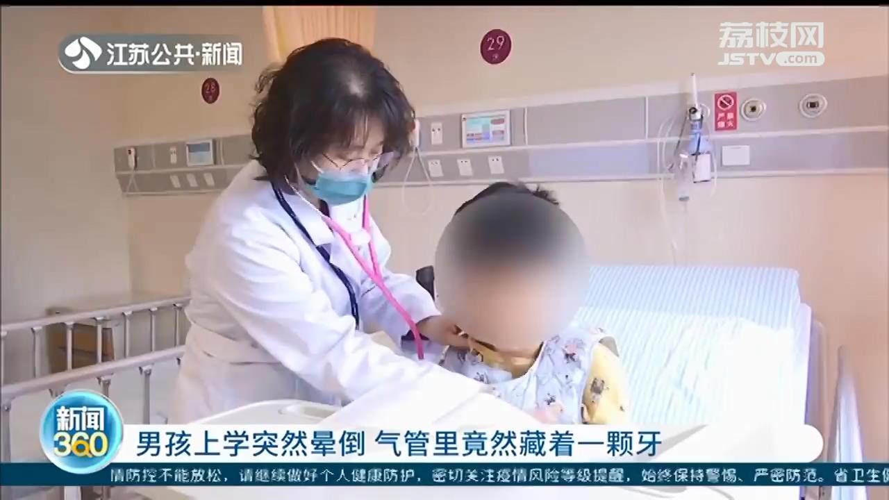 江阴10岁男孩上学突然晕倒 竟然从气管里取出一颗牙