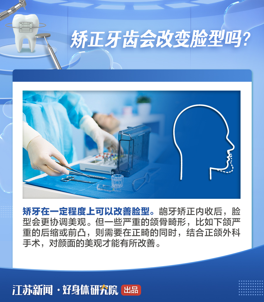 你与变美只差一个牙套的距离！牙齿矫正这8件事你一定要知道