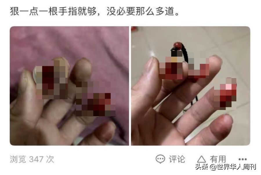 为给男友挡灾，10万女孩甘愿放血：恋爱脑到底有多疯狂？