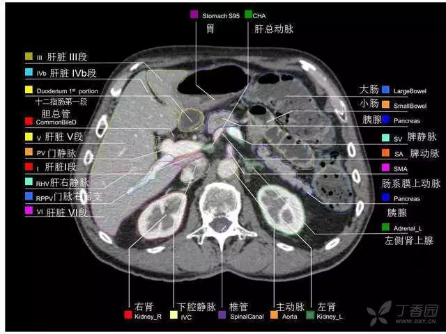 掌握这篇解剖，晋级腹部CT影像诊断高手（精细版）