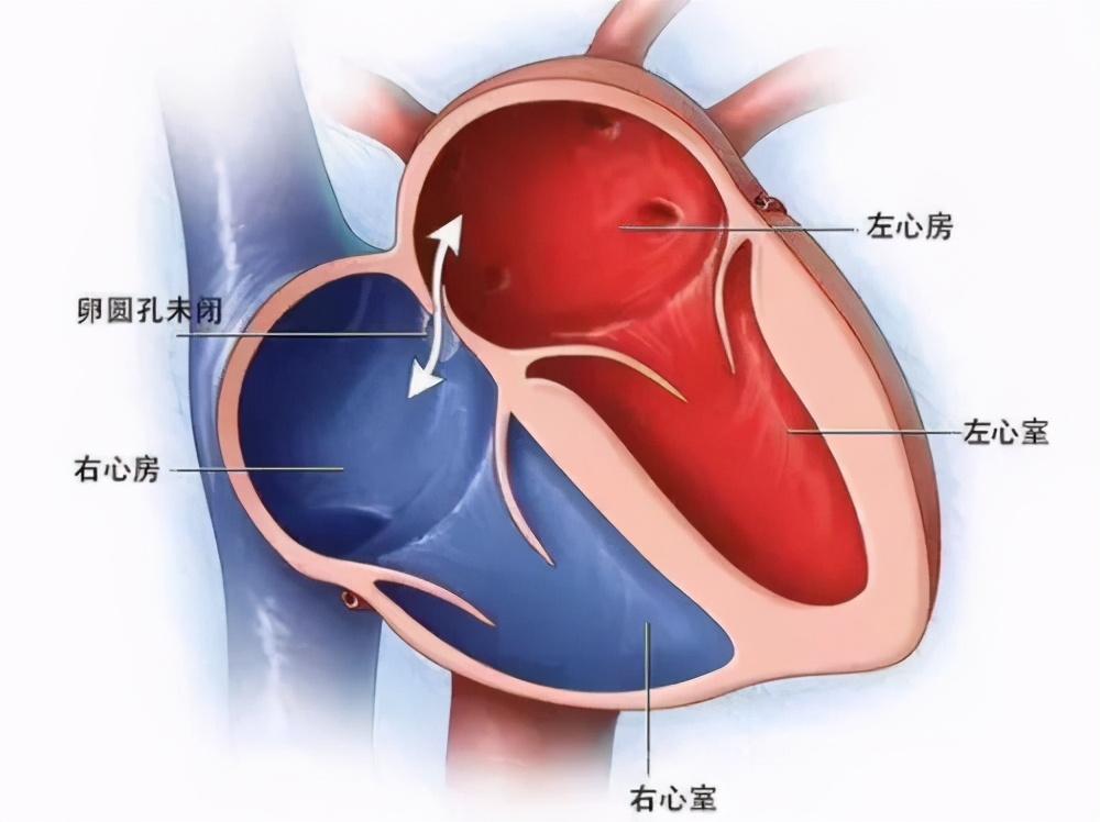 “多个心眼”倒霉了！57岁大妈肾、肺、脑血管堵塞，居然是“心眼”出问题了？