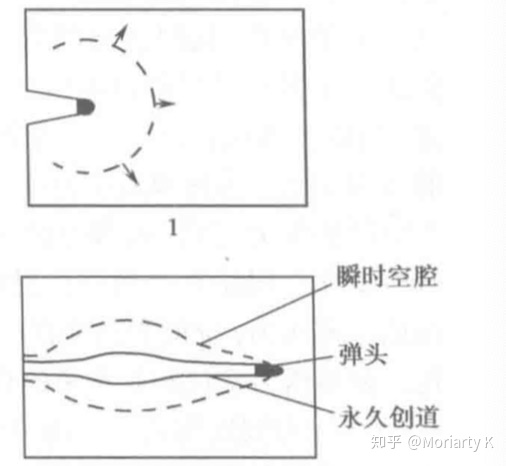 为什么中枪后要马上取出子弹？